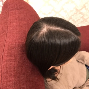 施術前の女性の髪